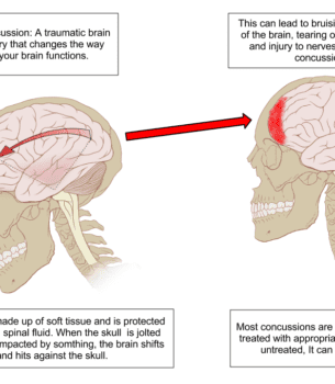 The Brain Health Blog by Dr. Brent Furnish Archives